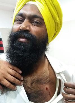 ਜ਼ਖਮੀ ਸੇਵਾਦਾਰ ਗੁਰਪ੍ਰੀਤ ਸਿੰਘ ਵੱਜੀ ਗੋਲੀ ਦਾ ਨਿਸ਼ਾਨ ਦਿਖਾਉਦਾ ਹੋਇਆ